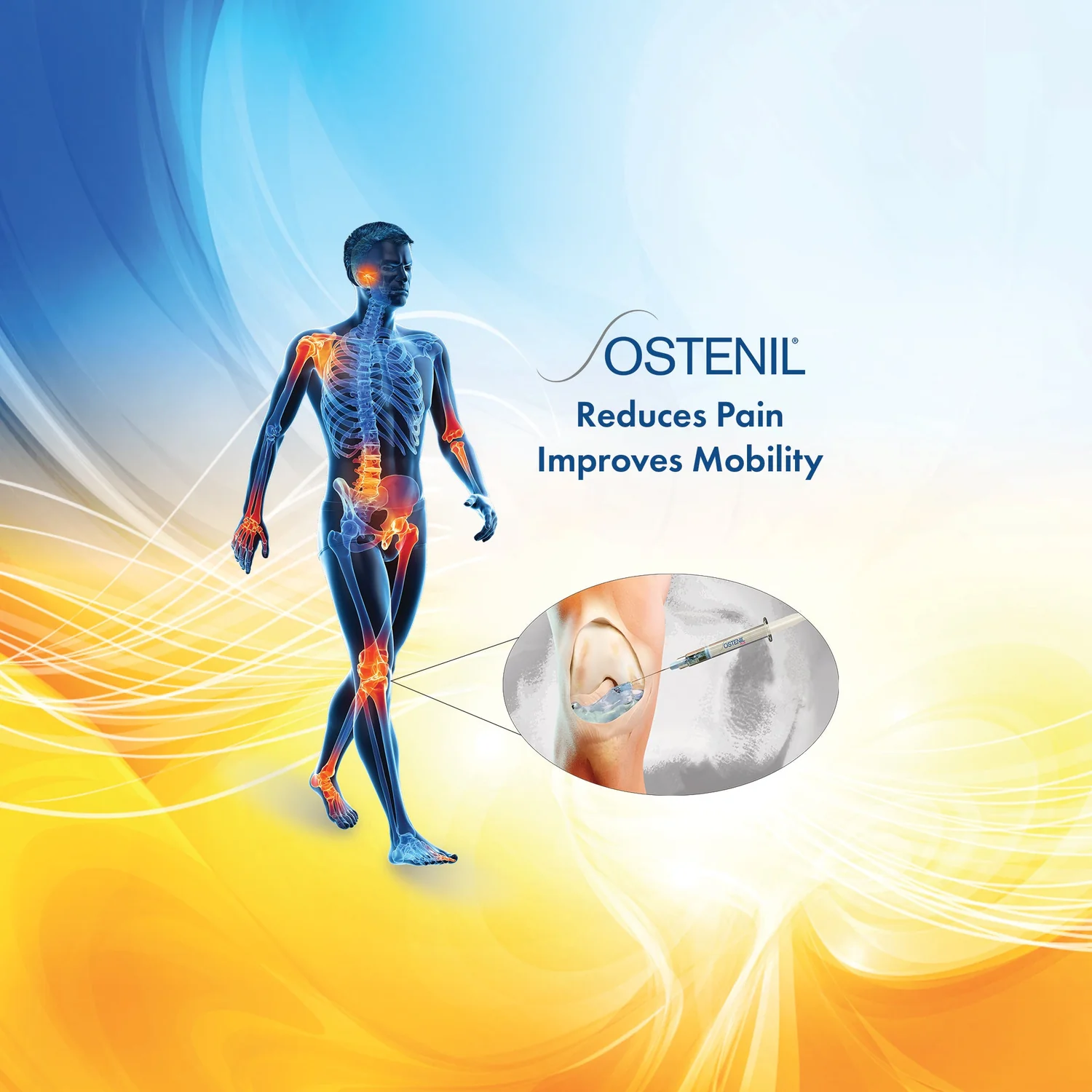 Ostenil